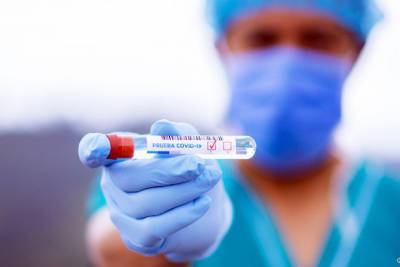 На Кубани за сутки подтвердили коронавирус у 62 человек