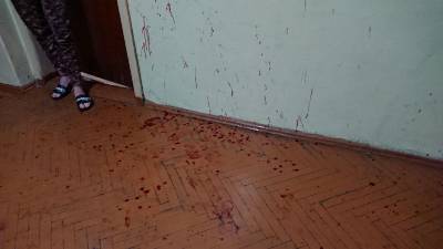 В Смоленской области в коридоре общежития нашли окровавленное тело