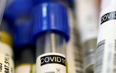 В Узбекистане коронавирус обнаружен у наркоторговца