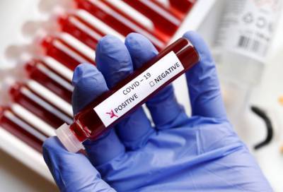 В Ленобласти выявлено 47 случаев коронавируса за сутки