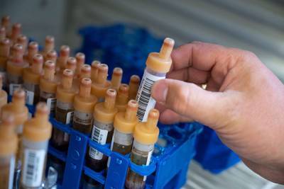 В России впервые получили антитела, нейтрализующие коронавирус