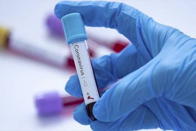 Первые испытания вакцины от коронавируса прошли успешно в США