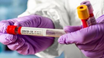 Москвичи могут сдать бесплатный ПЦР-тест на COVID-19 в 207 поликлиниках с 16 июля