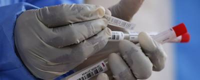 Жители Москвы смогут сдать ПЦР-тест на коронавирус бесплатно с 16 июля
