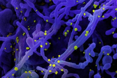 Опасное антитело обнаружено у больных с тяжелой формой COVID-19