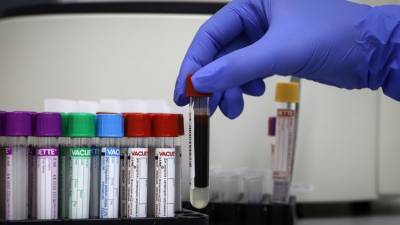 Инфекционист рассказал, где сдать тест на коронавирус в Крыму