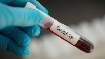 В Украине за сутки обнаружили 848 новых случаев коронавируса
