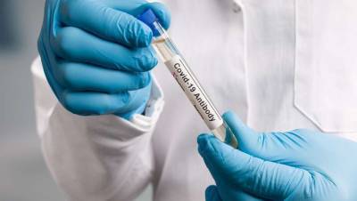 Лаборатории "Инвитро" начали проводить ИФА-тестирование на антитела к коронавирусу в Казахстане