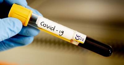 Почему тесты на коронавирус могут быть ошибочны