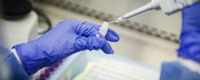 Еще 67 человек на Кубани заразились коронавирусом