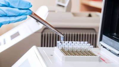 В лабораториях "Олимп" возобновили ПЦР-тестирование на коронавирус
