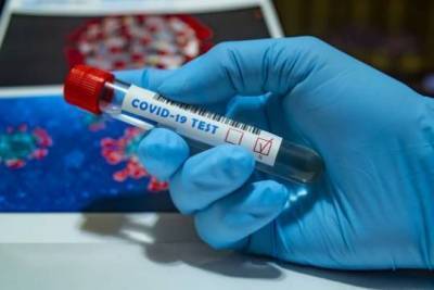 Эксперт заявил о стадии угасания коронавируса в России