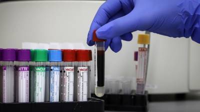 В России провели свыше 24 млн тестов на коронавирус