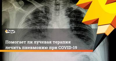 Помогает ли лучевая терапия лечить пневмонию при COVID-19