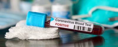 В Ростовской области выявлены еще 97 заразившихся COVID-19