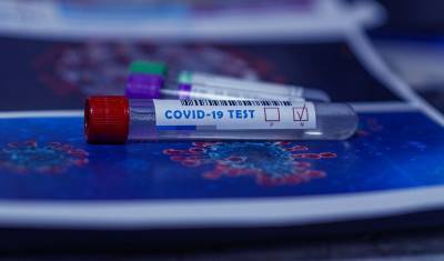 В России сделали свыше 24,3 миллионов тестов на коронавирус