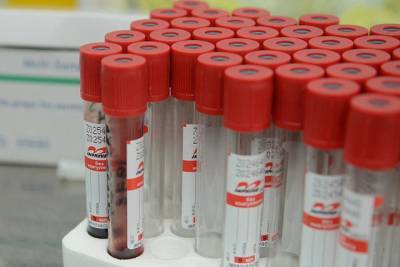 В Липецкой области за сутки коронавирусом заболел 31 человек