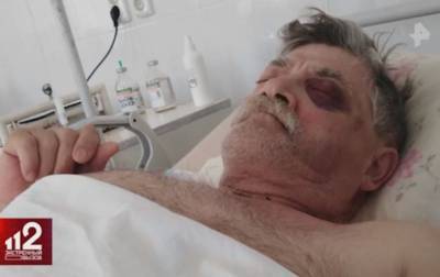 Депутат избил до комы пенсионера во время отпуска в Крыму