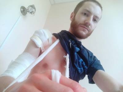 На Френкеля, которому полицейский сломал руку, составят протокол о неповиновении силовикам