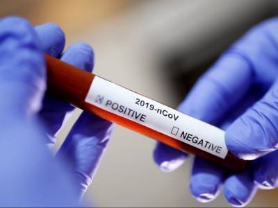 Ученый назвал главное противопоказание при вакцинировании от коронавируса