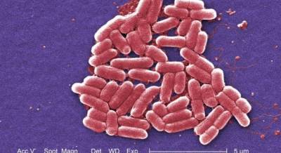 Ученые случайно открыли новую бактерию, которая ест металл