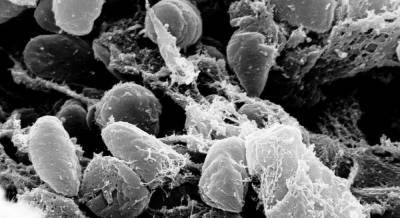 Не только в Азии: в США обнаружили заражения бубонной чумой