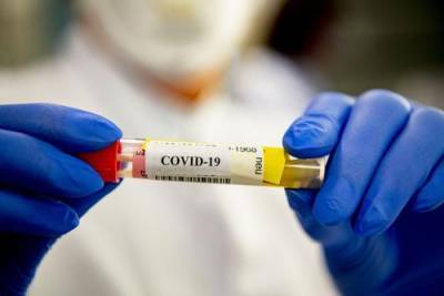 Количество жертв коронавируса в Крыму достигло 13 человек