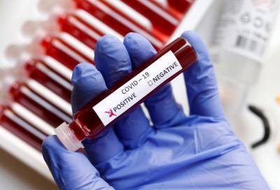 В Ленобласти на 19 июля выявлено 45 новых случаев коронавируса