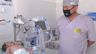 В Узбекистане на свет появился младенец с двумя головами - inform-ua.info - Узбекистан