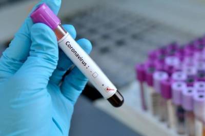 В Чувашии умер 32-й пациент с коронавирусом