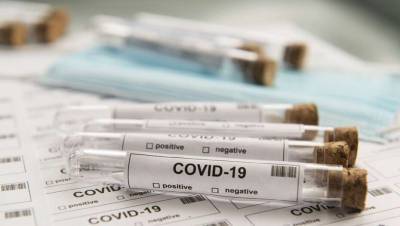 Надо ли сдавать ПЦР-тест и почему пациентов с ОРВИ относят к носителям Covid-19?