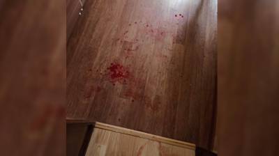 Под Воронежем проверят на вменяемость мать, ударившую ножом 4-летнюю дочь