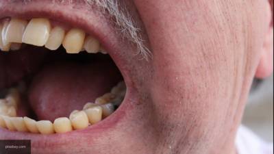 Стоматологи назвали причины белых пятен на языке