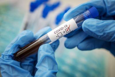 За последние сутки у 115 дончан диагностировали коронавирус
