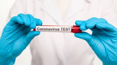 1630 новых случаев коронавируса выявлено в Казахстане за сутки