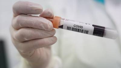 В ХК «Авангард» выявили 20 случаев коронавируса