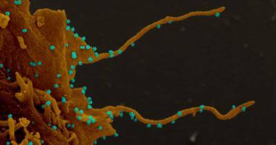У зараженных коронавирусом клеток найдены отростки