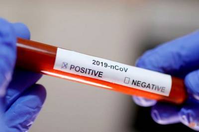 Американские ученые выяснили, почему коронавирус так быстро распространяется