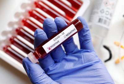 Новые случаи коронавируса выявили в девяти районах Ленобласти