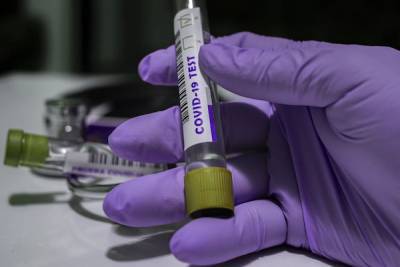 За сутки коронавирусом в России заразились еще 5 848 человек