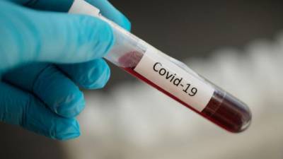 В ВСУ произошла вспышка COVID-19: за сутки зафиксировали 16 новых случаев заражения