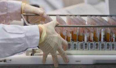 Анализ за 30 секунд: новейший израильский тест на коронавирус испытают в Индии