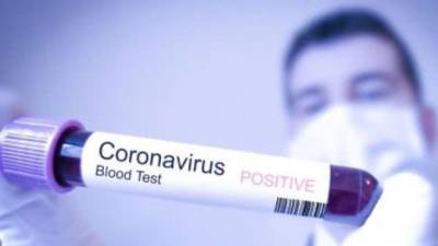 В Украине подтверждено 548 случаев коронавируса, умерло 13 больных