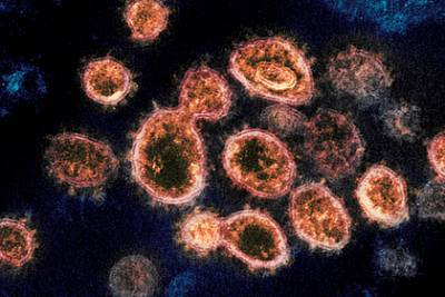 Исследователи назвали коронавирус непобедимым