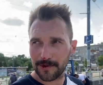 В Хабаровске напали на координатора «Открытой России», который освещал акции протеста