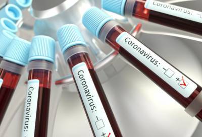 Новые случаи коронавируса выявлены в 30 населенных пунктах Ленобласти