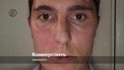 Ведущий канала Навального пожаловался в полицию на избиение в Хабаровске