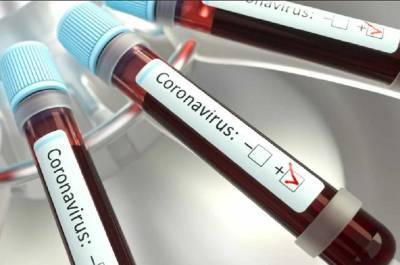 В Смоленской области выявили еще 30 заразившихся COVID-19