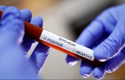 В КНДР заявили о первом случае подозрения на коронавирус в стране