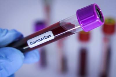 В России за сутки скончались 85 пациентов с коронавирусом